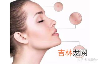 鼻头贴用过以后毛孔会变大吗,鼻子用黑头贴会使毛孔越来越大吗?