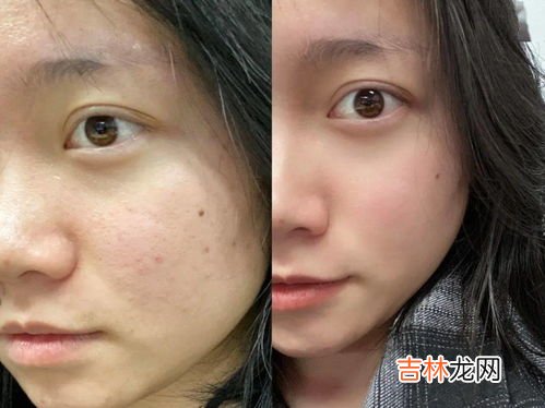 冬天紫外线强吗,冬天的太阳紫外线强吗