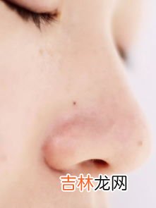 如何处理鼻子上的黑头,鼻头有黑头怎么去除最有效的方法