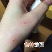 被猫猫抓伤需要打狂犬疫苗吗,猫抓了需要打狂犬疫苗吗？