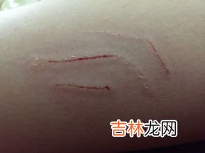 被猫猫抓伤需要打狂犬疫苗吗,猫抓了需要打狂犬疫苗吗?