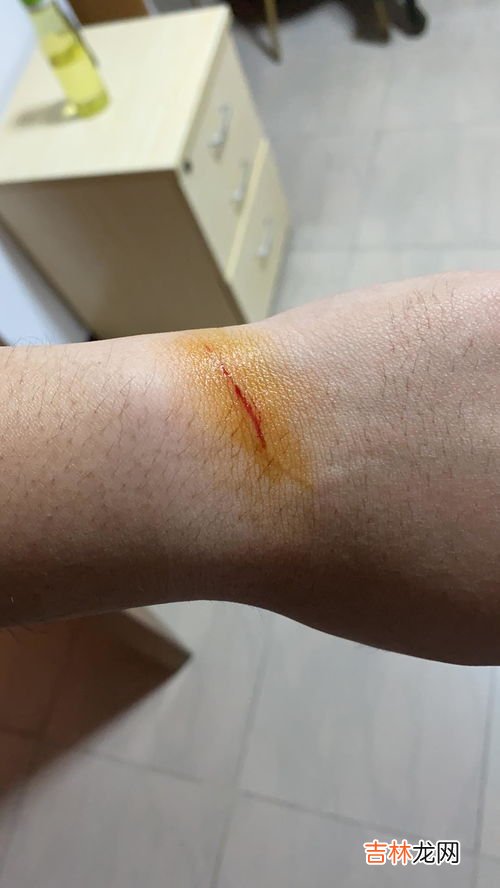 被猫猫抓伤需要打狂犬疫苗吗,猫抓了需要打狂犬疫苗吗?