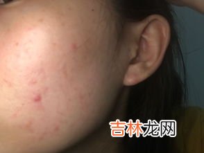 用白糖洗脸有什么好处,白糖洗脸有什么好处？为什么呢？