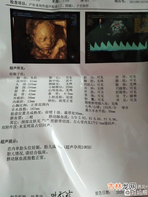 为什么四维需要预约,做四维彩超要预约吗?
