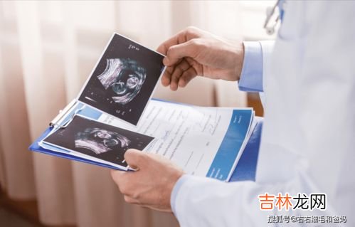 为什么四维需要预约,做四维彩超要预约吗?