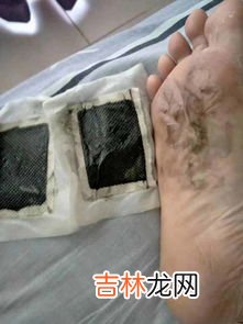 艾足贴的功效,艾叶足贴有用吗