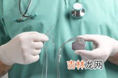 心脏起搏器医保报销吗,2022年浙江省温州市心脏起搏器医保报销吗