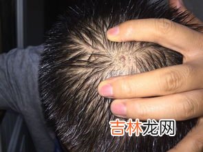 一个头有多少厘米,一个头多大多长