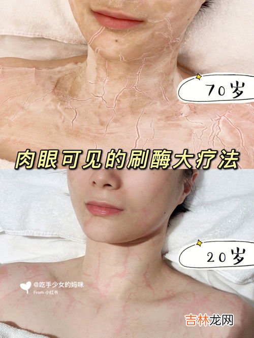 怎样保护皮肤,保护皮肤的最好方法