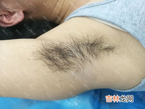 腋毛可以刮吗,腋毛能刮吗?有什么作用?