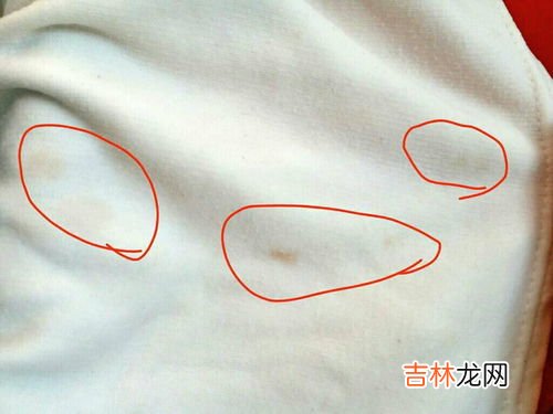 白衣服上的铁锈怎么去除,白色衣服染上铁锈了怎么能洗掉