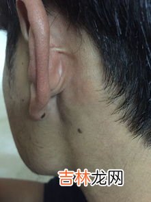 是福 男人耳朵长痣是福是祸,男人耳骨有痣代表什么含义？寓意好不好？