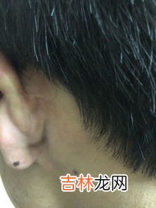 是福 男人耳朵长痣是福是祸,男人耳骨有痣代表什么含义？寓意好不好？
