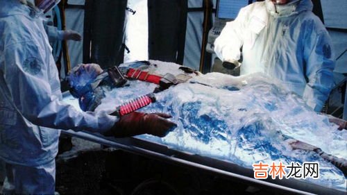 冰冻人解冻成功了吗,我想问一下世界第一位冷冻人成功了吗