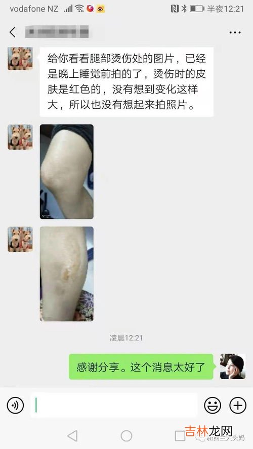 新西兰蜂胶滴剂的作用与功效,新西兰蜂胶滴剂有含酒精