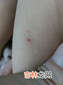 蜱虫是不是臭虫,臭虫和蜱虫是一样的吗?