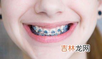 带牙套怎么刷牙,戴牙套后应该如何护理？