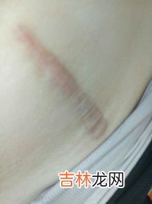 来月经为什么会头晕,月经期间为什么会头痛和头晕?