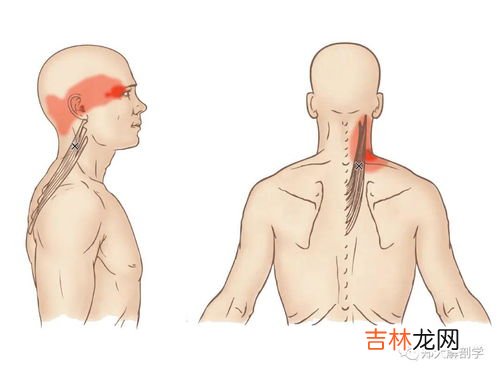 后脑勺疼怎么快速缓解,后脑勺疼怎么办