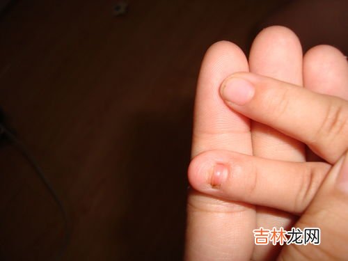 手足口耳目有关的生活用品有哪些,按要求作答，手足口耳目，人的五件宝。学习和劳动，天天离不了人的五件宝是什么？