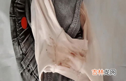 裤子上的血迹干了怎么洗掉,裤子上弄上血了怎么洗掉