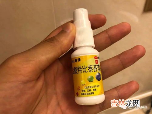 盐酸特比萘芬片治疗灰指甲有用吗,盐酸特比萘芬片治疗灰指甲要注意什么