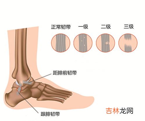 狗扭伤和骨折的区别是什么,狗扭伤和骨折的区别 狗扭伤和骨折的区别有哪些