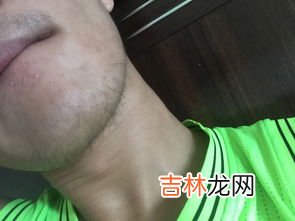 刮胡子刮不干净有黑印怎么去掉,我长有胡子，但刮完后胡子的部位还是黑黑的，请问有什么方法可以淡化胡子部位黑印的吗