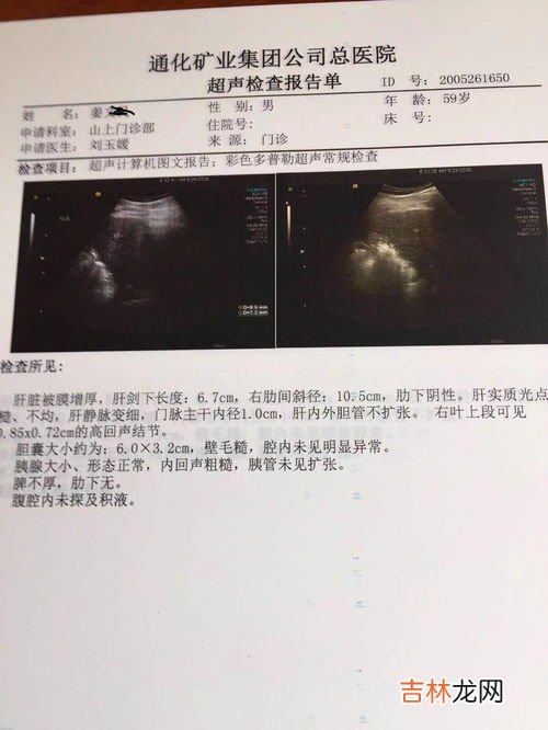 鱼油和磷脂的作用,深海鱼油和卵磷脂有什么作用?