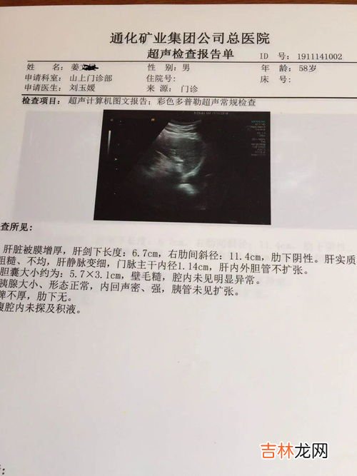 鱼油和磷脂的作用,深海鱼油和卵磷脂有什么作用?