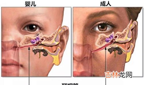 为什么一咽口水耳朵疼,耳朵里面疼是怎么回事咽口水也疼