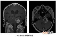 为什么会得肝脓肿,肝脏不好会导致哪些疾病的产生？