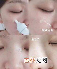 女人脸上为什么会长斑,女人脸上长斑是什么原因