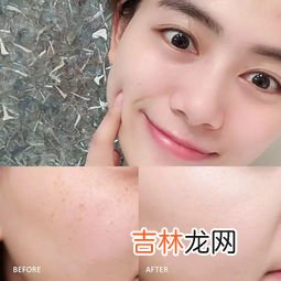 女人脸上为什么会长斑,女人脸上长斑是什么原因