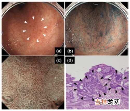 蛾蚋怎么根除,如何根除厕所里的蛾蚋