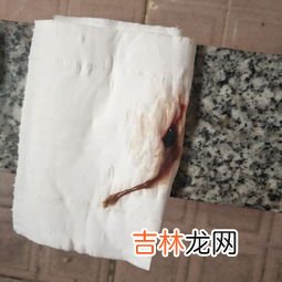 为什么白带像胶一样的东西,内裤上有粘粘的胶状物