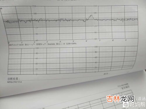 为什么胎心监护老不过,胎心监护不正常是什么原因