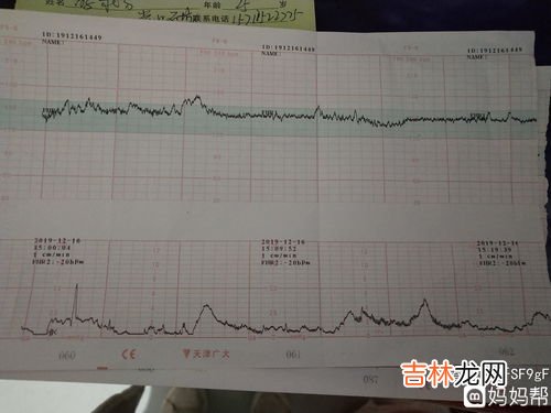 为什么胎心监护老不过,胎心监护不正常是什么原因