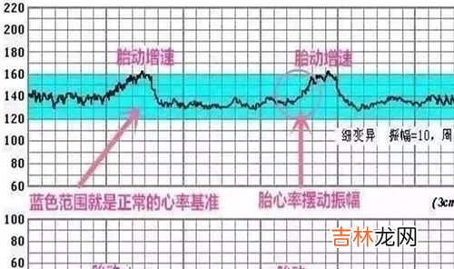 为什么胎心监护老不过,胎心监护不正常是什么原因