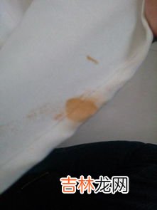 怎样洗掉血渍,血迹如何洗掉小妙招