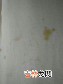 怎样洗掉血渍,血迹如何洗掉小妙招