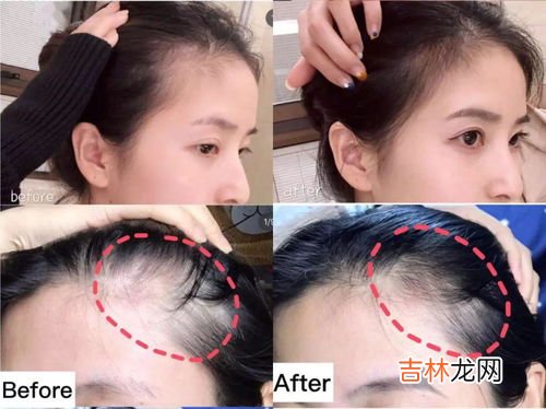 三十可以洗头发吗,大年三十小孩子不洗头发可以吗