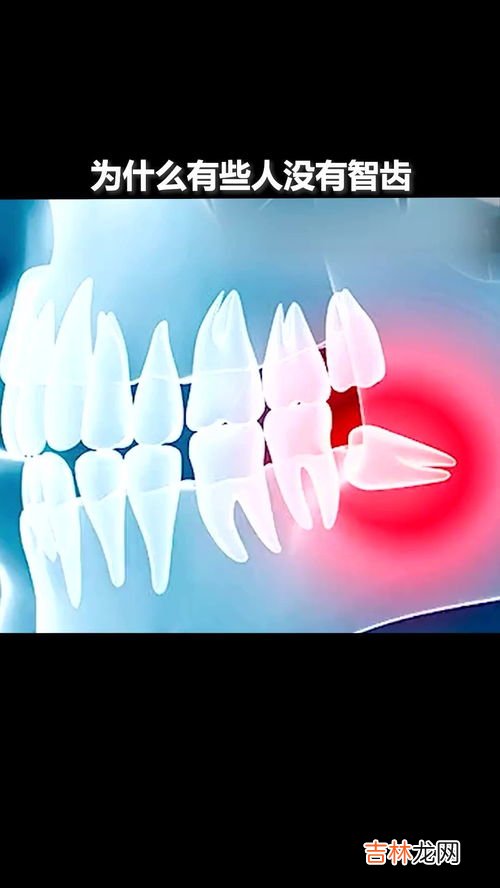 每个人都会长智齿吗,人的智齿什么时候才会长?是每个人都会长么?