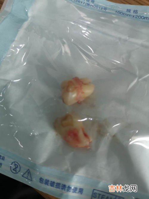 每个人都会长智齿吗,人的智齿什么时候才会长?是每个人都会长么?