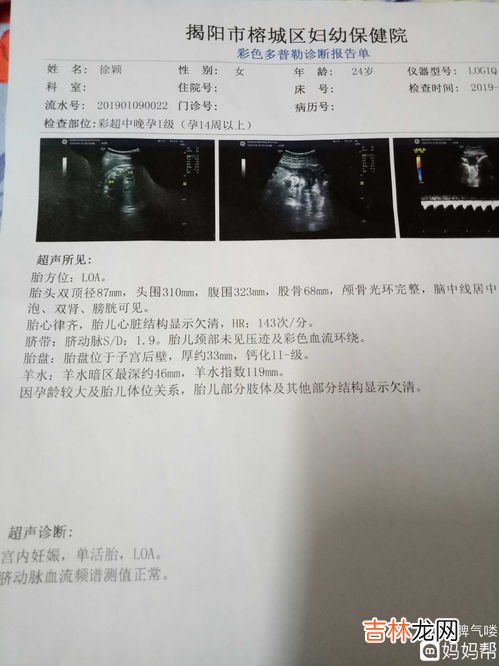 正常人头部尺寸,正常人的头长度多少厘米