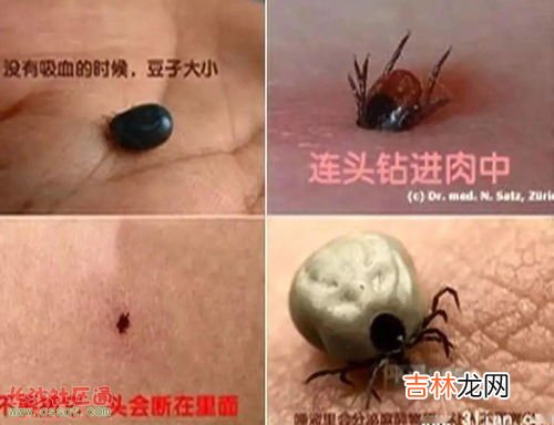 花露水能防蜱虫吗,花露水能预防蜱虫吗？