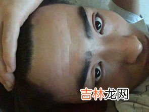 抬头纹太重怎么办,17岁抬头纹太重怎么办