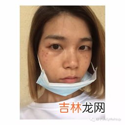 碧娟华素祛斑有效果吗,祛斑美白产品有没有谁用过真的有效果的。不希望是打广告的