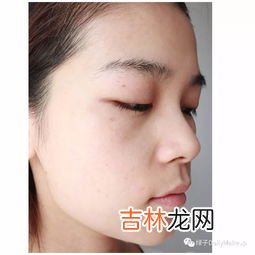 碧娟华素祛斑有效果吗,祛斑美白产品有没有谁用过真的有效果的。不希望是打广告的