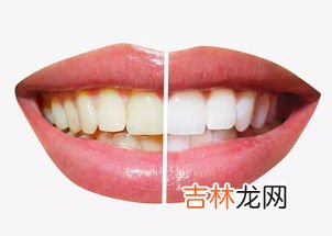 快速去牙齿烟渍小妙招,怎样去除牙上的烟渍？什么美白方法最好用?我好像陷进一个无法自拔的漩涡啊！
